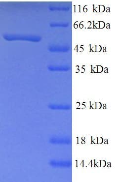 Human NPFF2 / NPFFR2 Protein (Recombinant His)