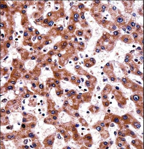 TRAP1 / HSP75 Antibody (aa542-570)