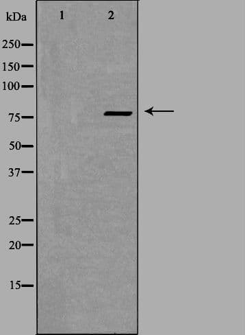 Polyclonal Rabbit anti-Human ZNF420 Antibody (IF, WB)