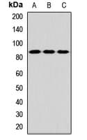 TLK2 Antibody