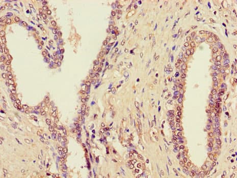 Polyclonal Rabbit anti-Human ZDHHC1 Antibody (IHC, IF, WB)