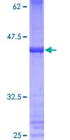 Human PRDM5 Protein (Recombinant GST)