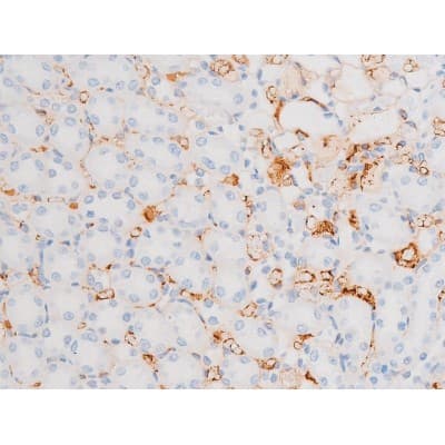 Polyclonal Rabbit anti-Human DNM1 / Dynamin Antibody (phospho-Ser774, IHC, WB)