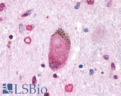 PathPlus™ GPER1 / GPR30 Antibody (N-Terminus)