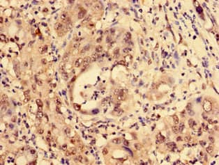 Polyclonal Rabbit anti-Human LDB1 / CLIM2 Antibody (IHC, IF, WB)