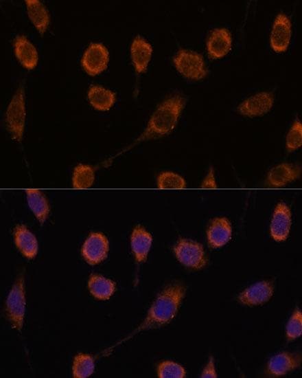 Polyclonal Rabbit anti-Human CCT6B Antibody (IF)