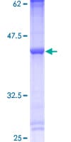 Human PLA2G5 Protein (Recombinant GST)