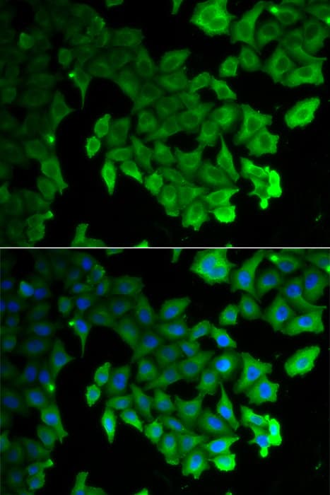 MAP1LC3A / LC3A Antibody