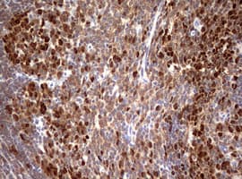 Monoclonal Mouse anti-Human TOP2A / Topoisomerase II Alpha Antibody (clone OTI2D12, aa1100-1531, IHC, WB)