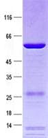Human ANP32B Protein (Recombinant GST, N-terminus + His, C-terminus)
