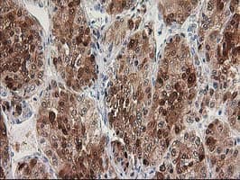 HDHD2 Antibody (clone OTI5C5)