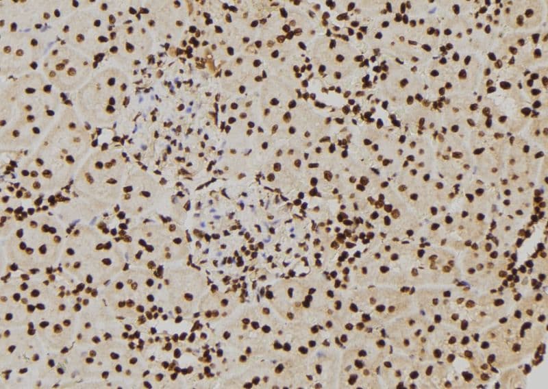 Polyclonal Rabbit anti-Human PIWIL2 Antibody (IHC, WB)