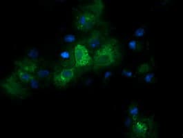RARRES1 Antibody (clone OTI1B3)