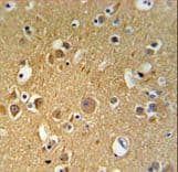 Polyclonal Rabbit anti-Human TUBB4B / Tubulin Beta 4B Antibody (aa99-125, IHC, WB)
