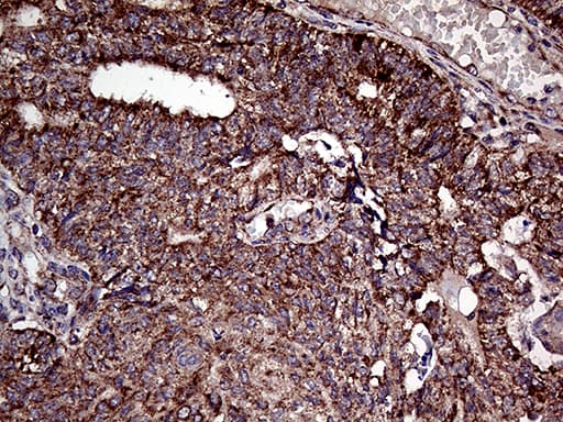 APG4B / ATG4B Antibody (clone OTI1A3)