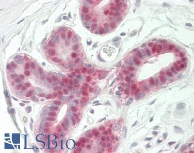 PathPlus™ NR4A2 / NURR1 Antibody (C-Terminus)