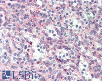 IHC-plus™ APG5 / ATG5 Antibody
