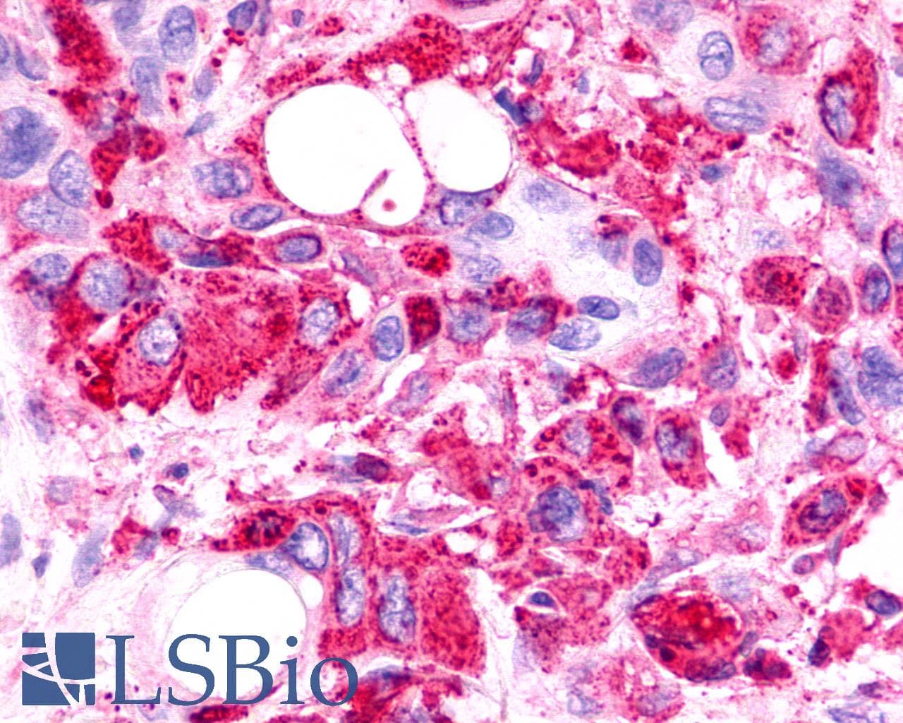 IHC-plus™ Polyclonal Rabbit anti-Human TPRA1 / GPR175 Antibody (Cytoplasmic Domain, IHC)