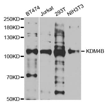 KDM4B / JMJD2B Antibody