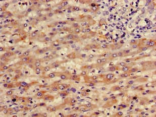 RBP4 Antibody (Biotin)