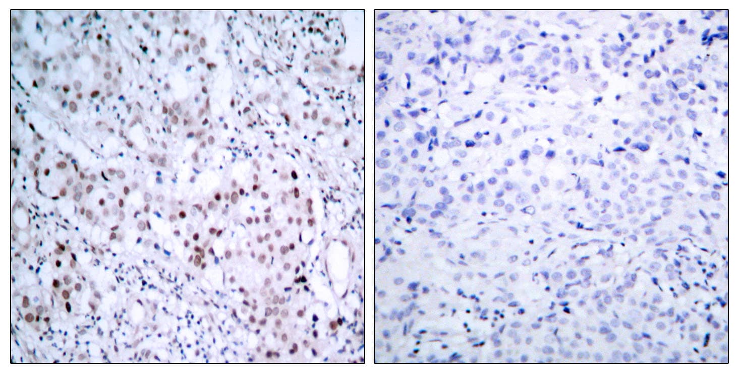 JUN / c-Jun Antibody (phospho-Ser63)