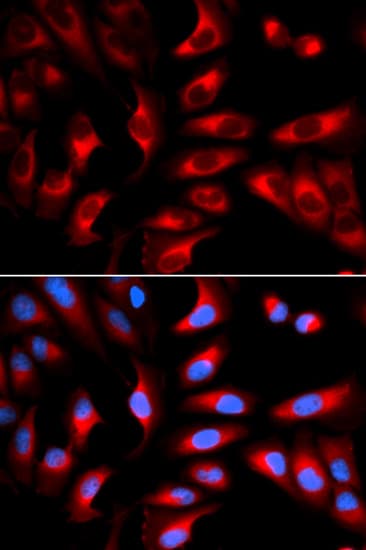 DNM1L / DRP1 Antibody