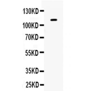 Polyclonal Rabbit anti-Human EPHB1 / EPH Receptor B1 Antibody (aa56-88, IHC, WB)