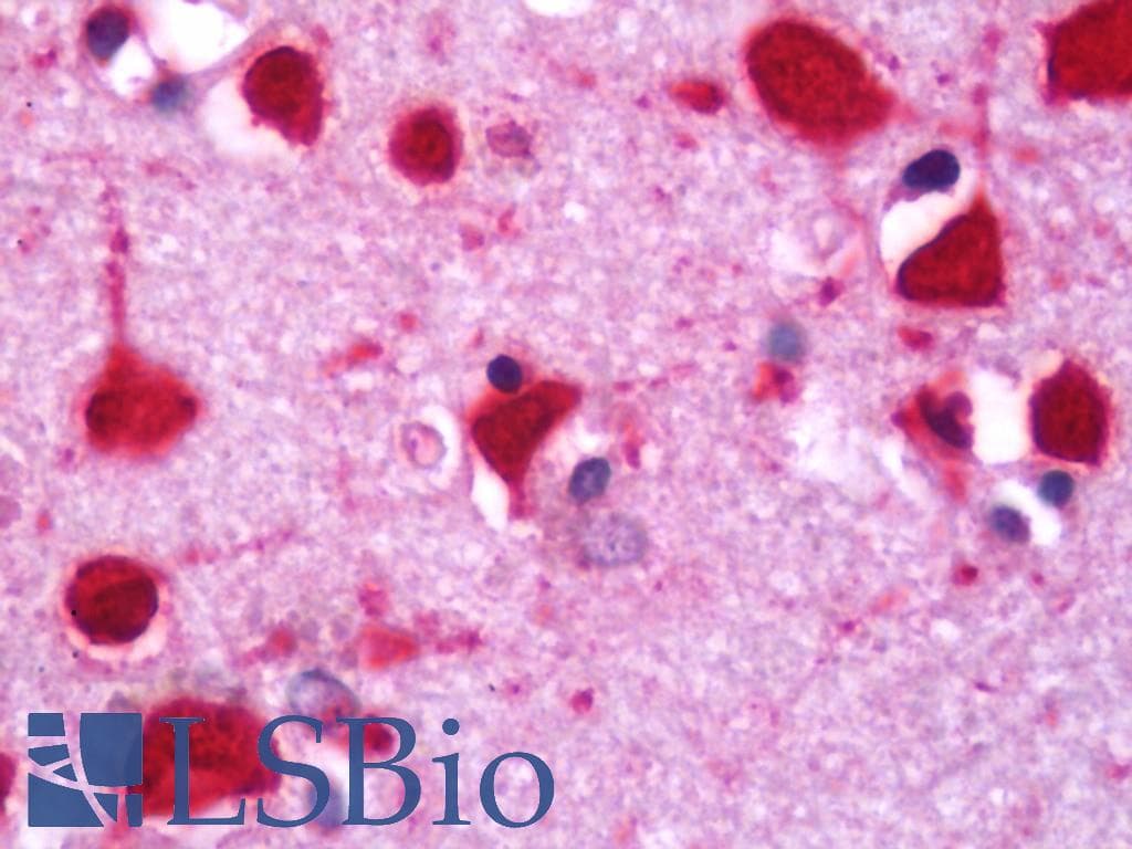 IHC-plus™ ITGA7 / Integrin Alpha 7 Antibody (clone 3C12)