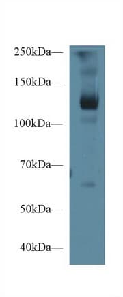 CD118 / LIF Receptor Alpha Antibody (aa692-833)