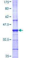 Human GABRB1 Protein (Recombinant GST, N-terminus)