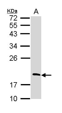 Polyclonal Rabbit anti-Human RGS13 Antibody (aa1-159, WB)