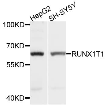 Polyclonal Rabbit anti-Human RUNX1T1 / ETO Antibody (IHC, WB)