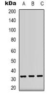 CD74 / CLIP Antibody (Internal)