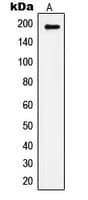 IRS1 Antibody (phospho-Ser1101)