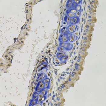 IHC-plus™ INHBB / Inhibin Beta B Antibody