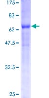 Human BNIP2 Protein (Recombinant GST)