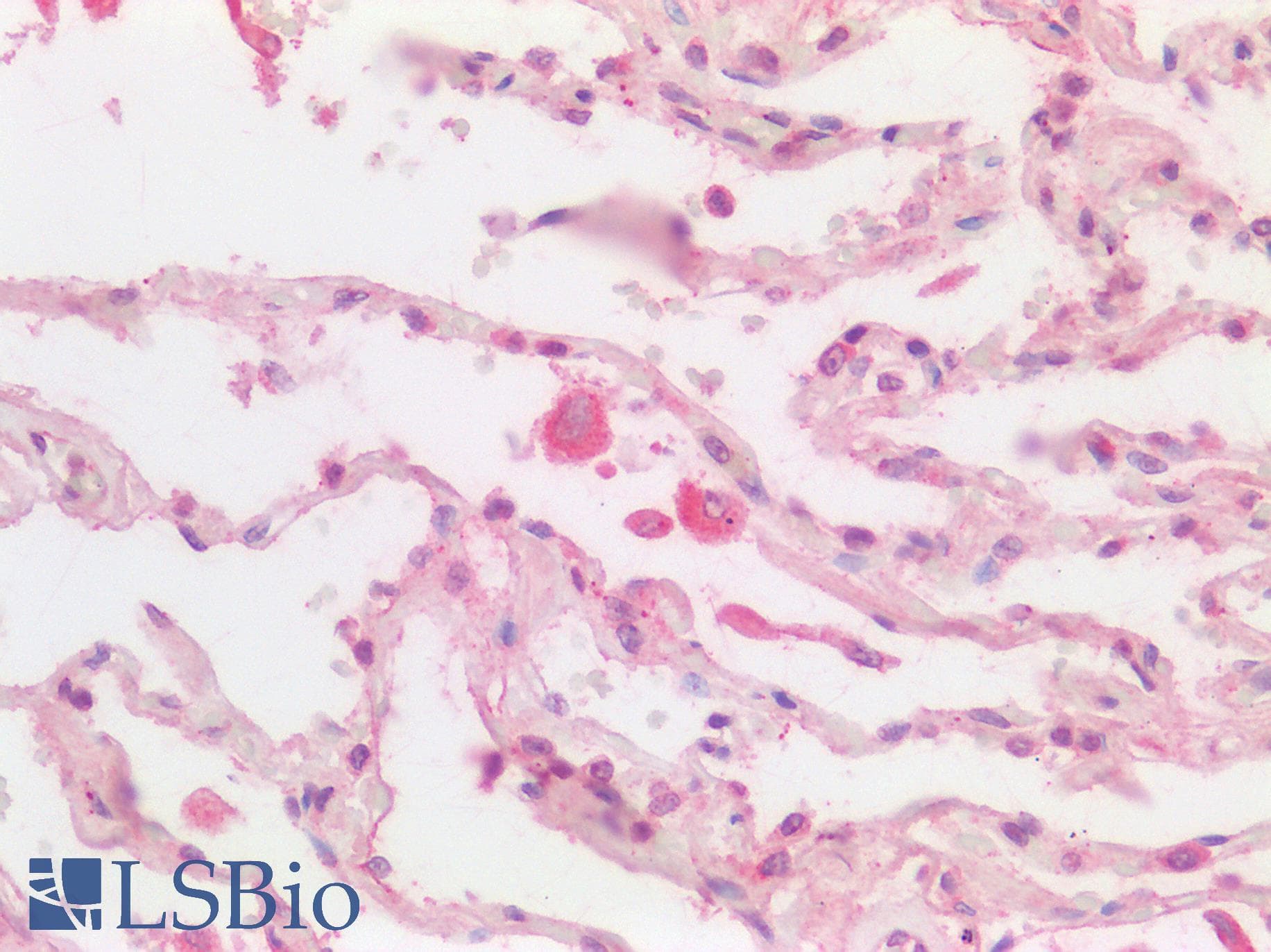 PPT1 / CLN1 Antibody (C-Terminus)