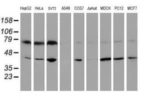 CRYZL1 Antibody (clone OTI1C9)