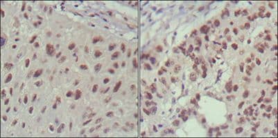 Monoclonal Mouse anti-Human ISLET-1 / ISL1 Antibody (clone 1H9, IHC, IF, WB)