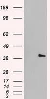 MAPK1 / ERK2 Antibody (clone OTI6F8)