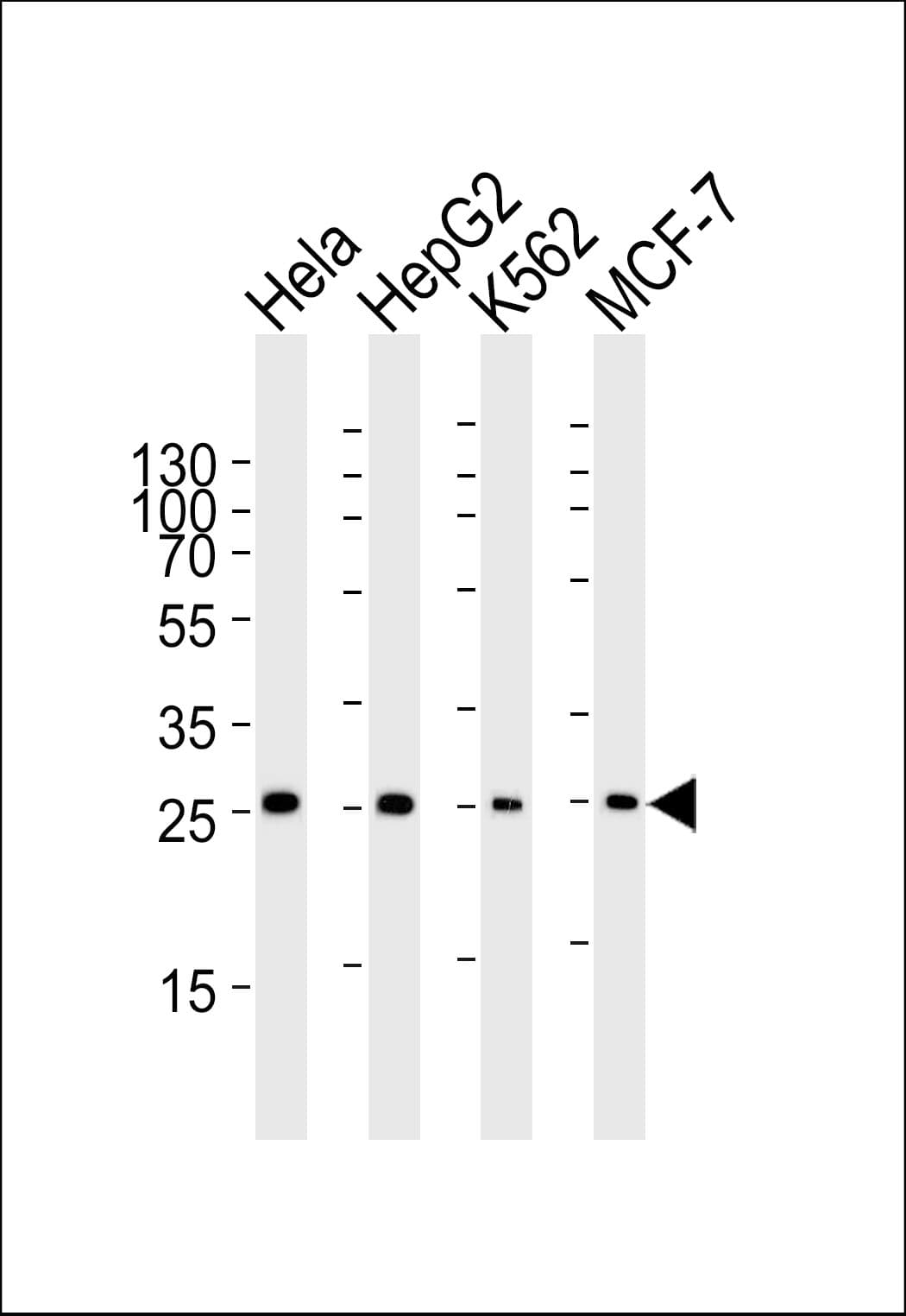 PMM2 Antibody (aa198-226)