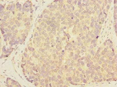 GALNT12 Antibody