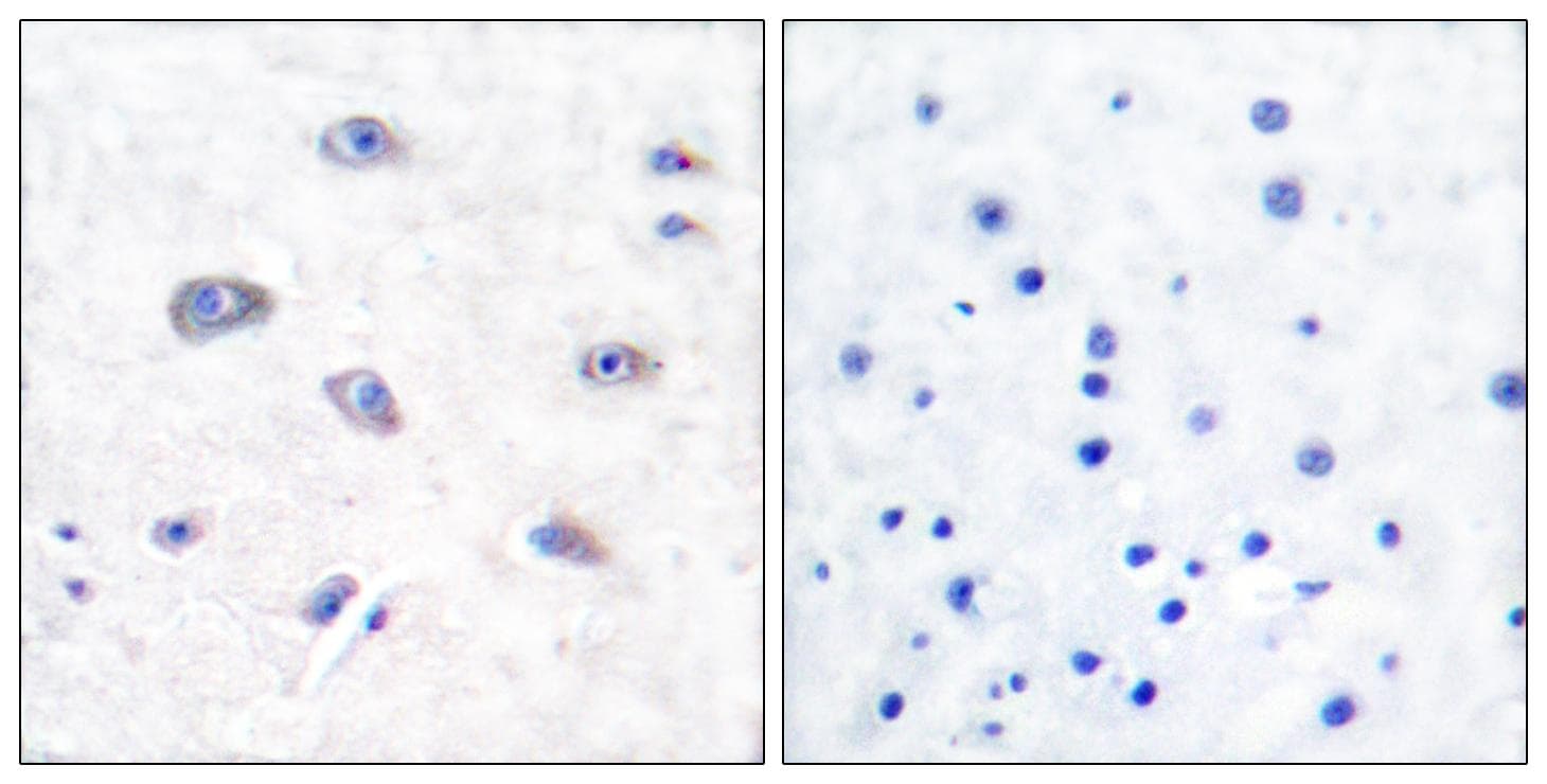 BACE1 / BACE Antibody