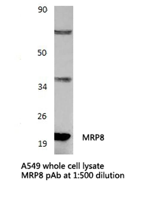 Polyclonal Rabbit anti-Human S100A8 / MRP8 Antibody (IHC, WB)