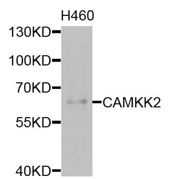 Polyclonal Rabbit anti-Human CAMKK2 Antibody (WB)