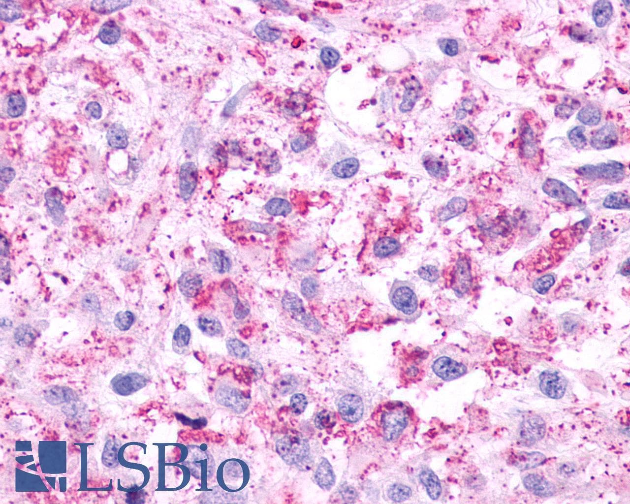 PathPlus™ Polyclonal Rabbit anti-Human HTR4 / 5-HT4 Receptor Antibody (Cytoplasmic Domain, IHC)