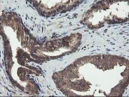 DOK7 Antibody (clone OTI1F7)