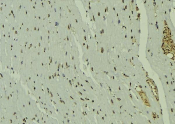 PPARD / PPAR Delta Antibody