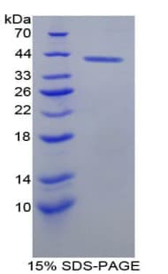 Rat BLC / CXCL13 Protein (Recombinant His-GST)