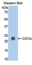 IL13RA1 / IL13R Alpha 1 Antibody (aa201-360)